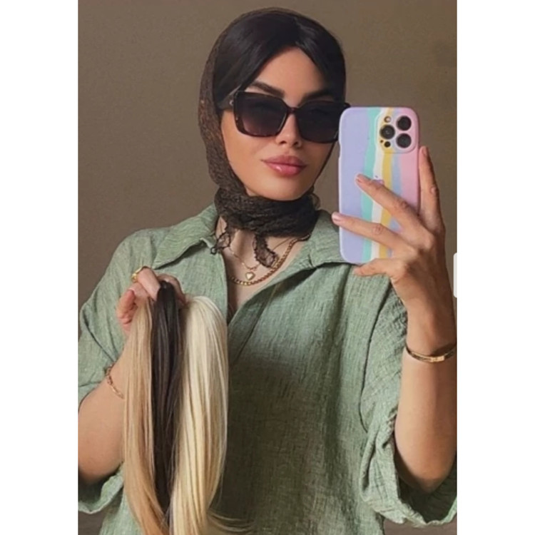 پروتز موی جلوی سری فرق پوستی