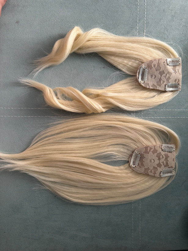 پروتز موی جلوی سری فرق پوستی